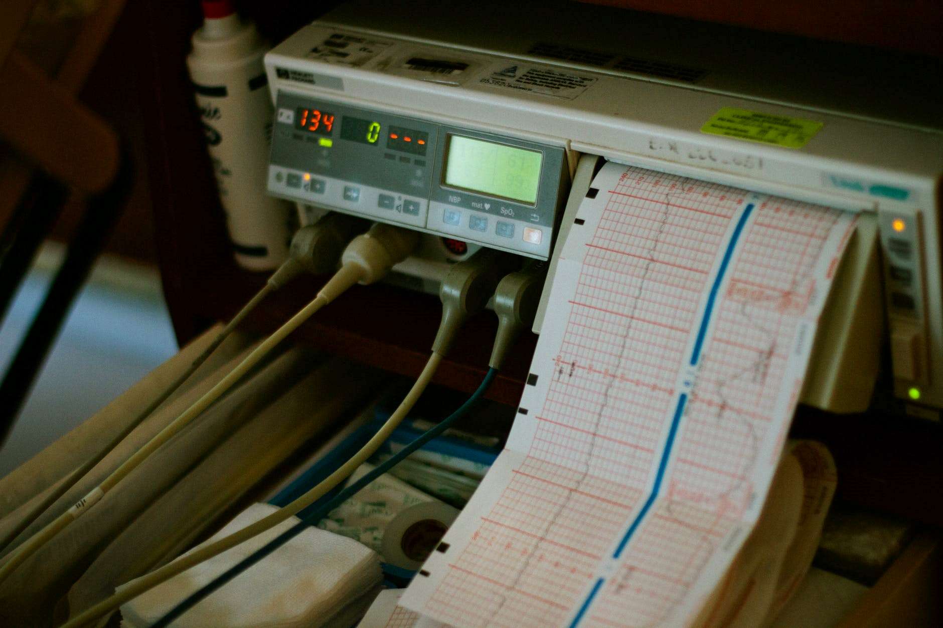 LQTS detection in ECG